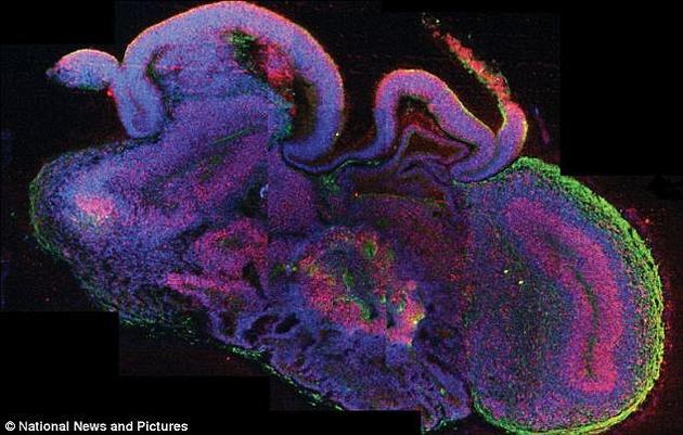 研究人员利用人类皮肤细胞培育出了一些豌豆大小的“大脑”。图为发育中的人类大脑（左图）和“类大脑”（右图）的对比。