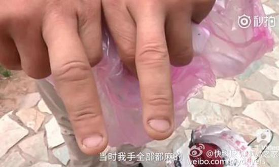 苹果7爆炸:苹果将进一步调查了解国行iPhone7爆炸事件 视频截图