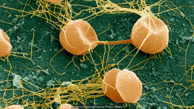 图为一种名叫Pyrococcus furiosus的嗜热古细菌。