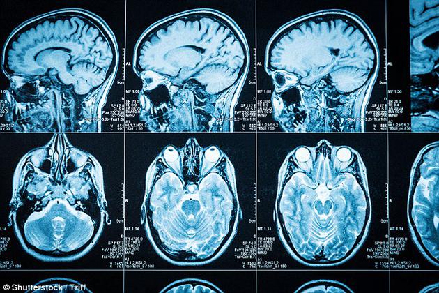 科学家近日发明出一种技术，可以让人在毫不知情的情况下提升自信心。