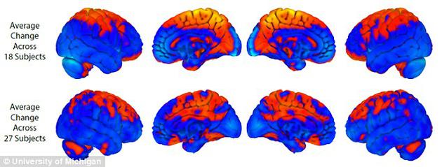 第一行为长期卧床病人的脑部变化，第二行为宇航员的脑部变化。橙色代表灰质增加区域，蓝色代表大脑灰质减少区域。两者有重叠之处，但可以明显看出，宇航员的小脑变化更加显著，而小脑与学习新运动技能有关。