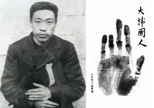 韩国人有“火病”,中国人也有专属精神疾病! 刺杀伊藤博文的朝鲜人安重根,曾自断一节左手无名指(图片来源于网络)