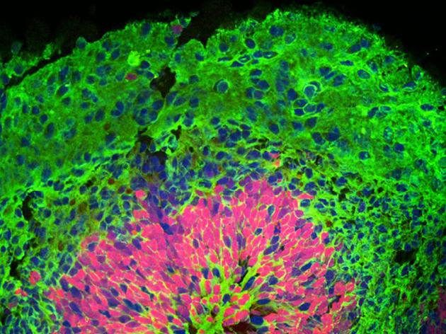 图为耶鲁干细胞中心培育的大脑皮层类器官。其中的着色区域展现了不同组织层次的各种细胞组织。图中的类器官培育时间为40天。蓝点为细胞核，红色为神经元前期细胞，绿色为分化后的神经元。