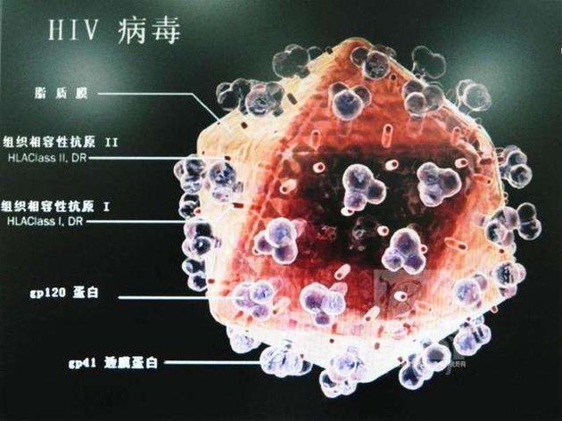 世界首例成人HIV抗体阴性合并肺KS有助艾滋病研究