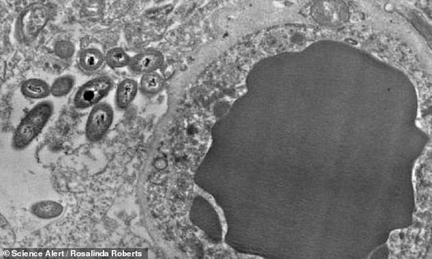 阿拉巴马大学的科学家声称首次发现了细菌可顺着血液、从肠道到达大脑的证据。图中左侧可见椭圆形细菌，右侧为体积更大的血细胞。