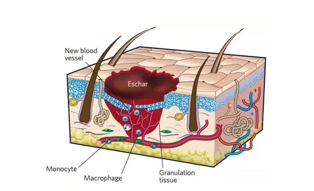 重编程得到皮肤干细胞 首次实现创口原位皮肤再生