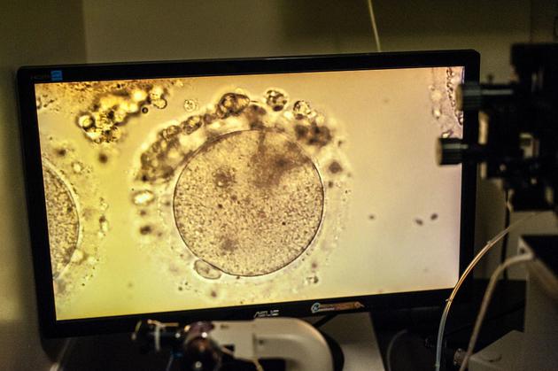 不孕不育重大进展：日本科学家用血细胞造出卵原细胞