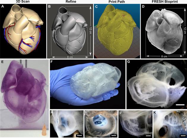 从核磁共振扫描到海藻酸盐3D打印心脏的变化过程，可以看到完好的内部结构