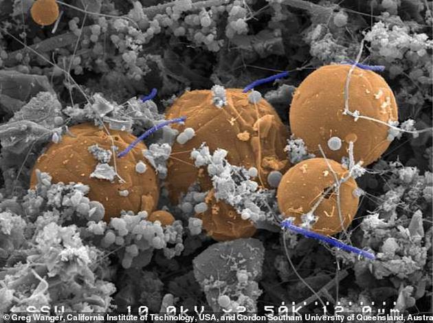 图为一种以氢气为生的微生物。科学家在南非约翰内斯堡地下约2.8公里处的一处充满液体与气体的裂隙中发现了它的存在。