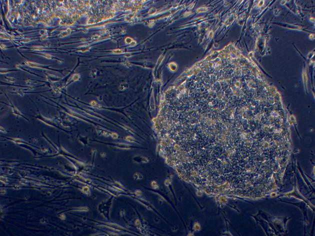 图片右侧为一团诱导性多功能干细胞簇。如果条件适宜，其中每个细胞都可以发育成精子或卵子细胞。