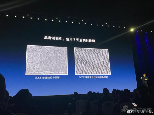 Sharklet是表面处理技术,不让细菌附着