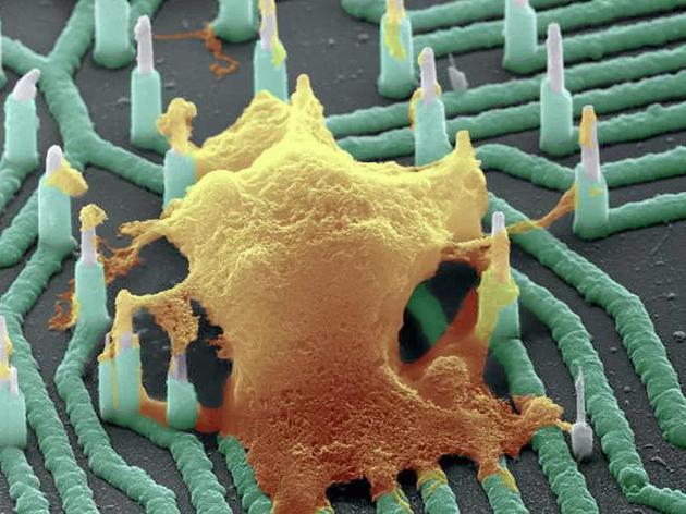 神经元（橙色）与纳米线阵列接触的彩色扫描电镜图像

　　图片来源：Thiago Arzua， Massive Science