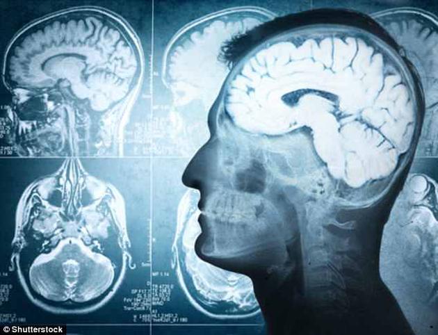 人脑体积的增长或由200万年前恶劣的生存环境导致。一项新研究指出,人脑之所以这么大,主要与生态挑战有关,而不是之前认为的社会挑战