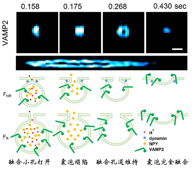图1：海森结构光显微镜解析囊泡融合孔道形成全过程。上图：实际的动态过程解析；下图：由实验结果得到的囊泡融合的四个中间态。