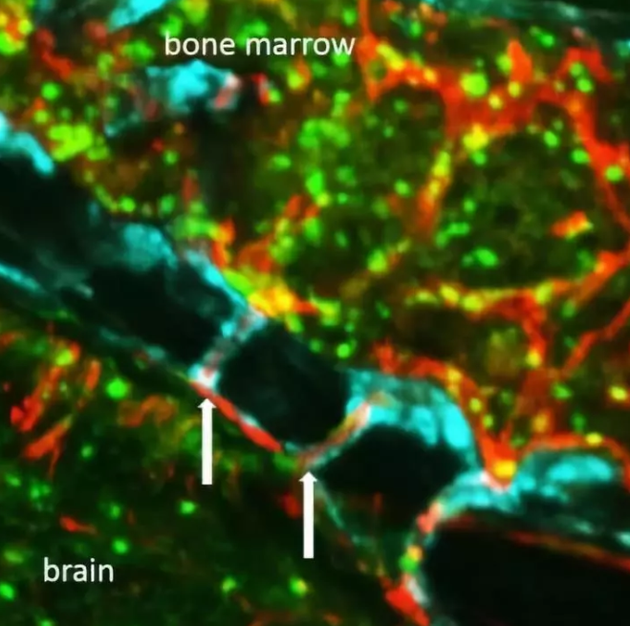  头骨中新发现的通道可以为免疫细胞进入受损组织提供捷径。图片来源：Nahrendorf Lab