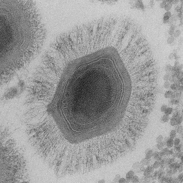这种拟菌病毒（mimivirus）是几年前才发现的巨型病毒之一