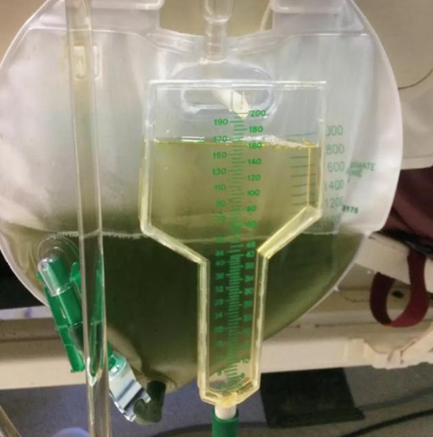 　图片来源：《新英格兰医学杂志》