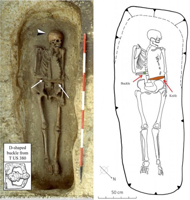 考古学家最近发现了一具中世纪意大利武士的骸骨。他的一侧手臂被截肢，并且断腕处接上了一把匕首。