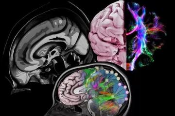 曾宣告失败的阿尔茨海默病新药起死回生 明年申请上市