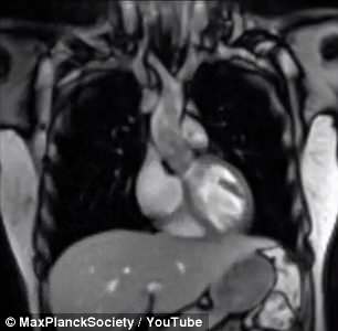 研究人员革新核磁共振成像技术 实时生成生理活动生理马克斯·普朗克研究人员
