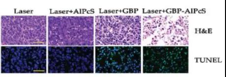 各实验组肿瘤切片的细胞形态（上）与细胞凋亡（下）（图片来源：论文）