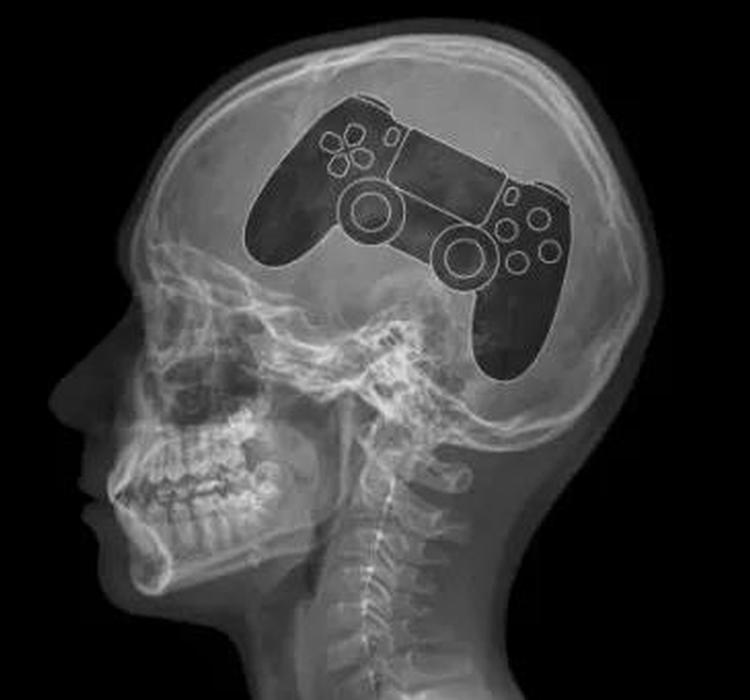 关于游戏成瘾被列为精神疾病，你以为的可能都是错的