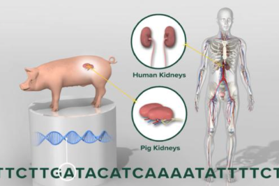 猪器官移植再传捷报!全球首例猪肾脏成功移植入人体