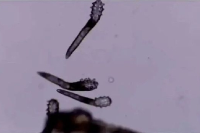 螨蟲“時日無多”？英媒：螨蟲DNA之間差異越來越小，或向滅絕