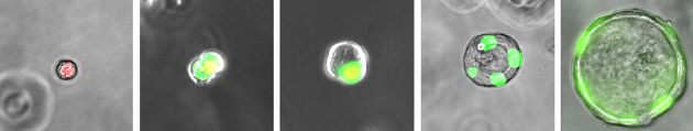 左图是“缓慢变形”的RAS细胞；右图是培养皿中RAS细胞转化成AT2细胞。