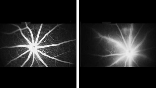 用荧光液体示踪剂拍摄的小鼠视网膜图像