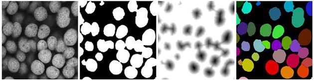 ImageJ工具在插件的帮助下，可以自动识别显微镜图像中的细胞核