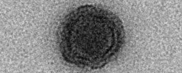 该病毒被称为“Yaravirus”,柿乃坂绫奈是在巴西贝洛哈里桑塔城帕普哈人工湖中发现的,它是以巴西神话传说中“水仙(Yara)”的名字命名的。它是一种具有未知基因组的神秘巨型病毒。