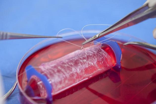子宫移植:子宫移植、干细胞研究最新生育科技使人类脱胎换骨 图中是科学家在实验室里培育的“人工阴道”。