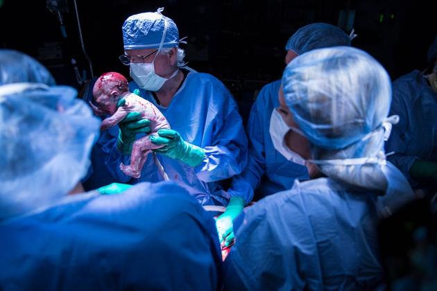 子宫移植、干细胞研究 最新生育科技使人类脱胎换骨