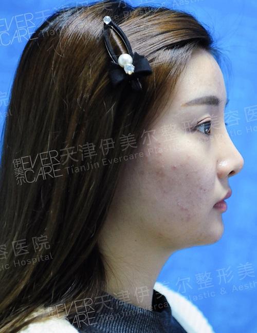 如何让自己的脸部和脖子线条更明显 Pi6o-fxpftya4295286.jpg