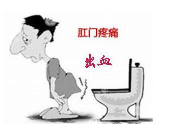 外痔用什么药可以消除?痔疮药哪种好