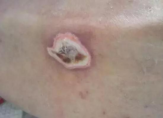 74岁天津老人被送养老院5个月竟忽然过世