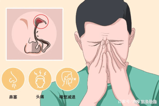 鼻窦炎的病因及患病机制