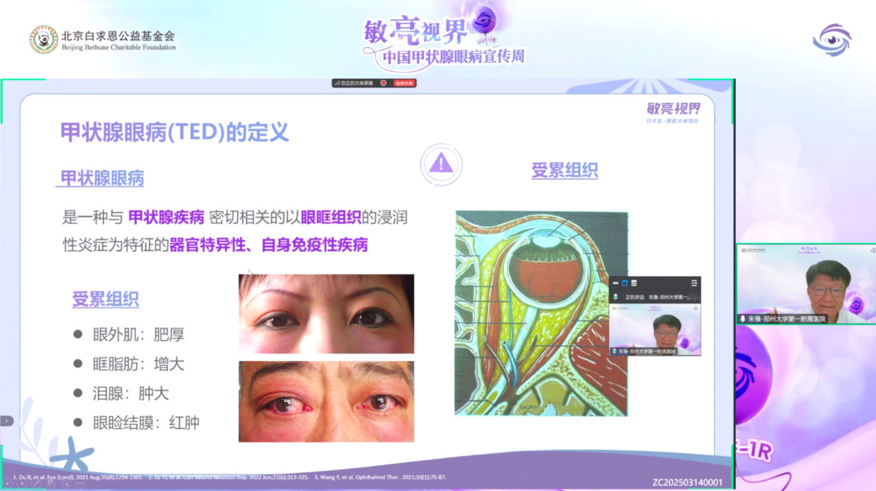 甲狀腺眼病宣傳周｜朱豫主任權(quán)威開講，揭秘甲狀腺眼病科學(xué)管理的“全景圖”