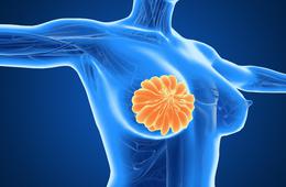 乳房八种变化可能预示癌症