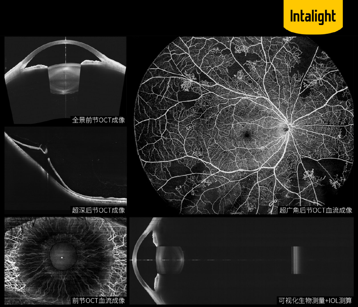  Intalight Saiwei won round D financing of more than 100 million yuan, and initiated trade secret infringement and patent ownership litigation against Tupai