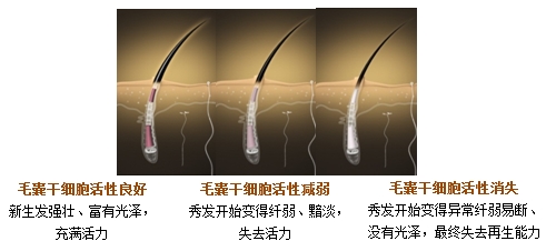 解读毛囊干细胞解密秀发质量根源|巴黎<em>卡诗</em>|毛
