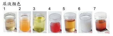 尿里的“彩虹”世界