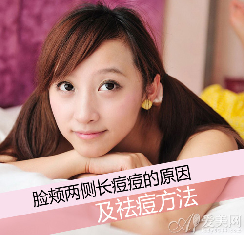 直击脸颊两侧长痘的原因 从源头精准祛痘|原因