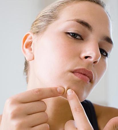 5个祛痘法下巴长痘不再愁