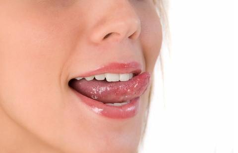 舌头粘膜慢性损伤是主因