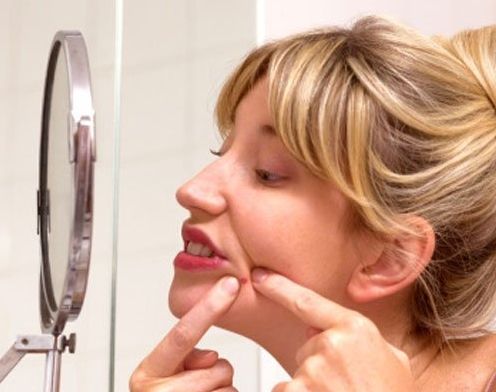 下巴长痘怎么办对号入座再处理|下巴|原因|油