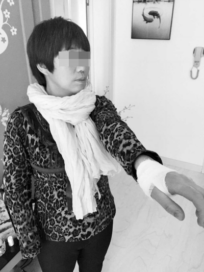 受伤的滕女士
