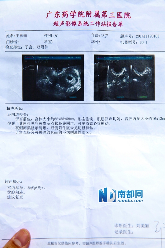 王女士在广药附属第三医院做的检查报告。南都记者 黎湛均 摄