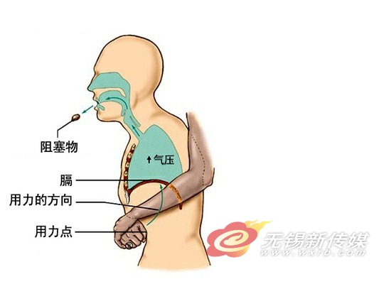 吃东西被哽可急救:学学海姆立克急救法